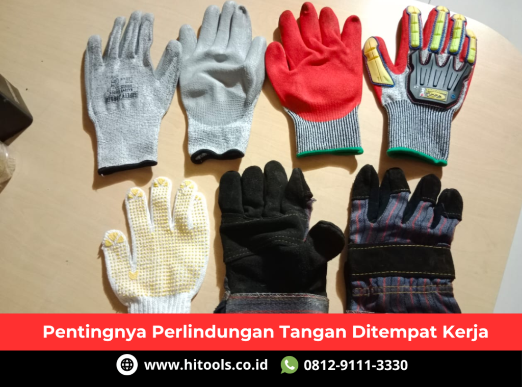 Pentingnya Perlindungan Tangan Ditempat Kerja 6 Pentingnya Perlindungan Tangan Ditempat Kerja
